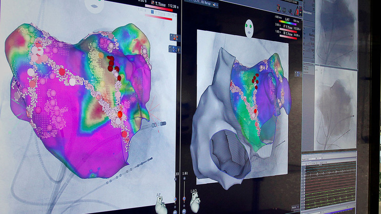 Examination images from the Department of Electrophysiology in the Clinic for Cardiology in the Albertinen Hospital/Albertinen International in Hamburg Examination images from the Department of Electrophysiology in the Clinic for Cardiology in the Albertinen Hospital/Albertinen International in Hamburg